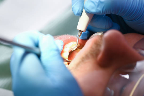 Best Weekend Emergency Dentist in Blue Bell, PA